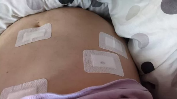 “为了在婚礼上看起来漂亮,我打了一针减肥针,结果却进了急诊室。”