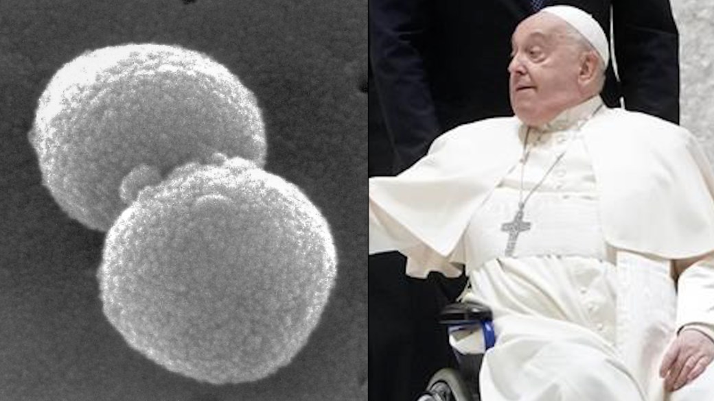 医生说,教皇方济各(Pope Francis)因肺炎和败血症的威胁而身体虚弱